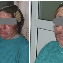 FOTO. Bătrână din Vâlcea, bătută crunt de fiul ei. Poliția a emis ordin de protecție